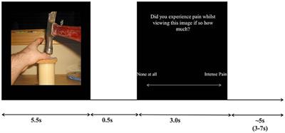 Consciously Feeling the Pain of Others Reflects Atypical Functional Connectivity between the Pain Matrix and Frontal-Parietal Regions